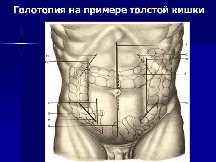 Проекция слепой кишки