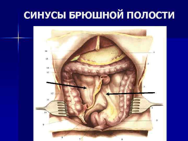 СИНУСЫ БРЮШНОЙ ПОЛОСТИ 