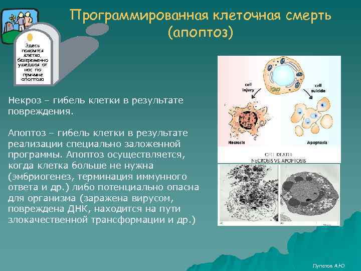 Программированная клеточная смерть (апоптоз) Здесь покоится клетка, безвременно ушедшая от нас по причине апоптоза