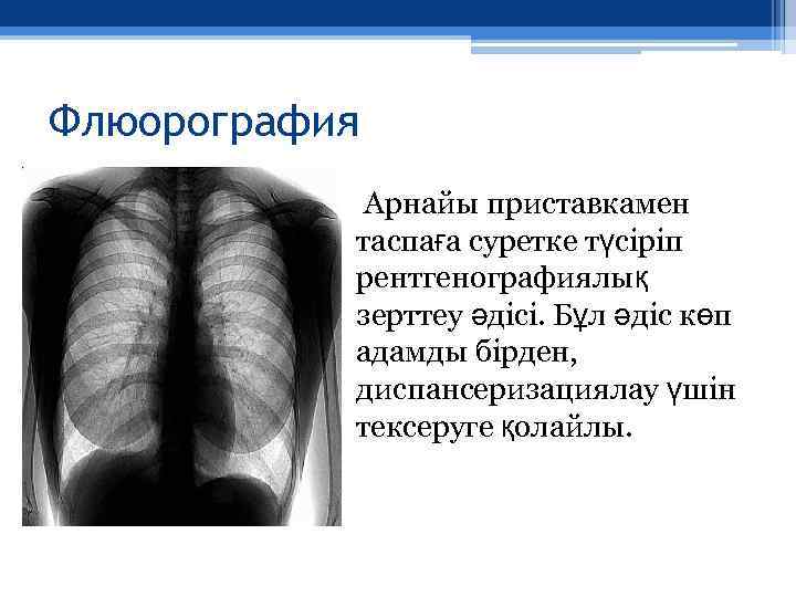 Флюорография Арнайы приставкамен таспаға суретке түсіріп рентгенографиялық зерттеу әдісі. Бұл әдіс көп адамды бірден,