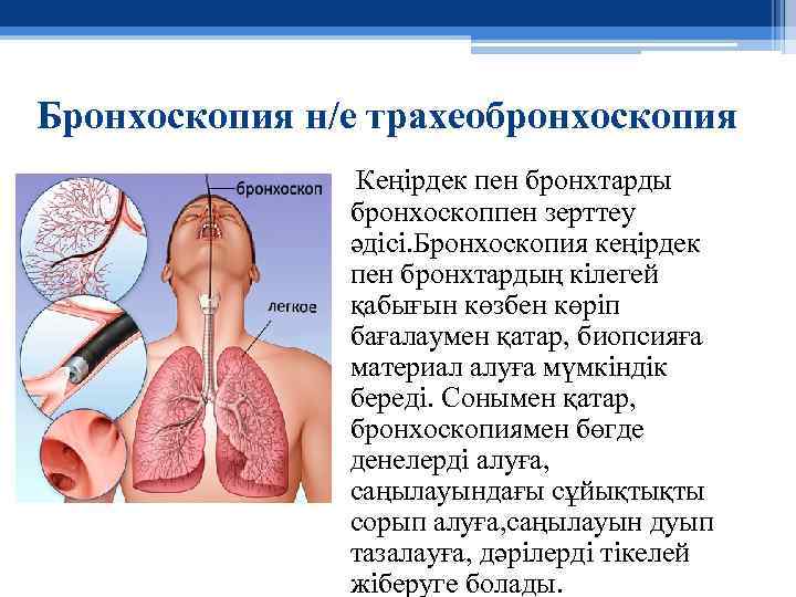 Бронхоскопия н/е трахеобронхоскопия Кеңірдек пен бронхтарды бронхоскоппен зерттеу әдісі. Бронхоскопия кеңірдек пен бронхтардың кілегей