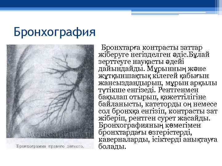 Бронхография Бронхтарға контрасты заттар жіберуге негізделген әдіс. Бұлай зерттеуге науқасты әдейі дайындайды. Мұрынның және