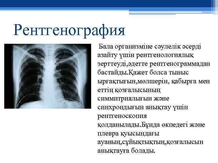 Рентгенография Бала организміне сәулелік әсерді азайту үшін рентгенологиялық зерттеуді, әдетте рентгенограммадан бастайды. Қажет болса