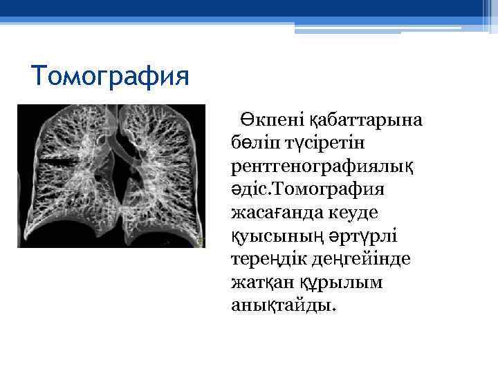 Томография Өкпені қабаттарына бөліп түсіретін рентгенографиялық әдіс. Томография жасағанда кеуде қуысының әртүрлі тереңдік деңгейінде