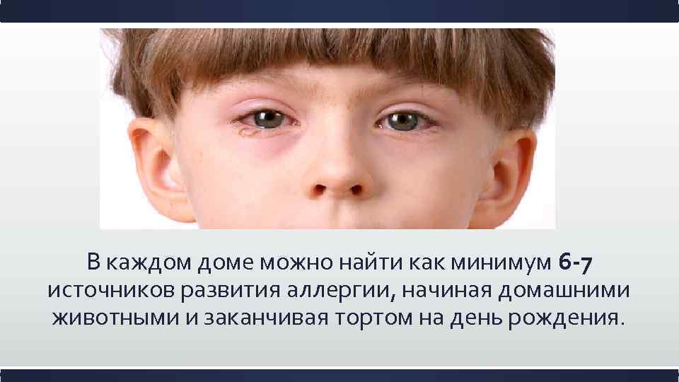 В каждом доме можно найти как минимум 6 -7 источников развития аллергии, начиная домашними