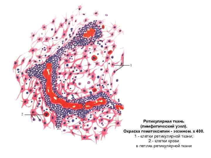 Лимфатическая ткань. Ретикулярная ткань лимфатического узла гистология. Ретикулярная ткань лимфатического узла препарат гистология. Гистологический препарат лимфатический узел ретикулярные клетки. Ретикулярная ткань лимфатического узла рисунок.