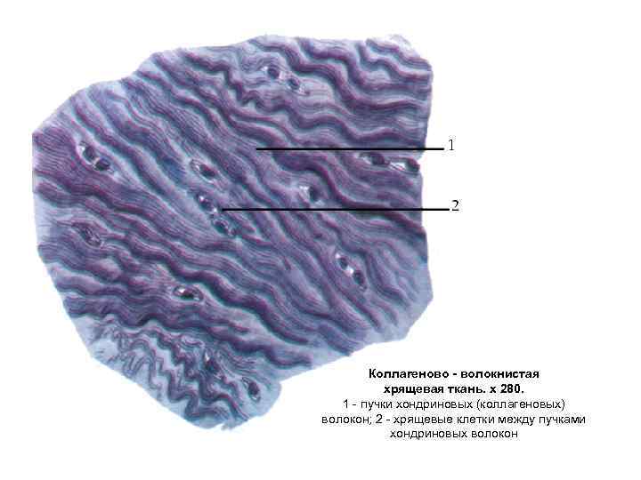 Волокнистый хрящ гистология. Коллагеновые волокна гистология надхрящница. Волокнистая хрящевая ткань гистология. Коллаген волокнистый хрящ гистология. Коллагеном волокнистая хрящевая ткань.