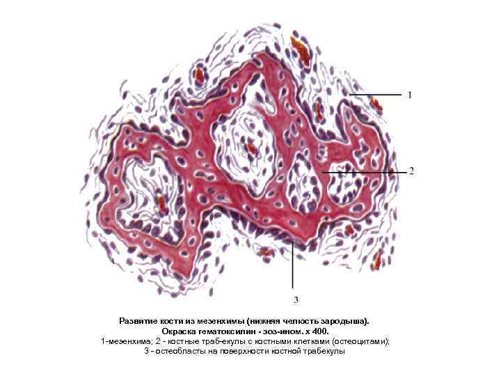 Развитие кости из мезенхимы (нижняя челюсть зародыша). Окраска гематоксилин эоз ином. х 400. 1