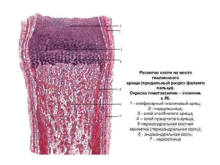 Развитие кости на месте хряща гистология рисунок