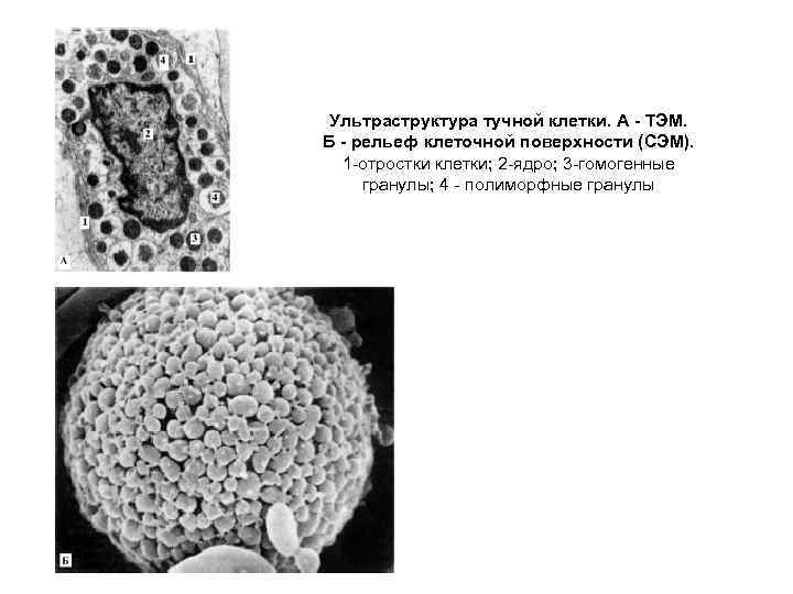 Ультраструктура тучной клетки. А ТЭМ. Б рельеф клеточной поверхности (СЭМ). 1 отростки клетки; 2