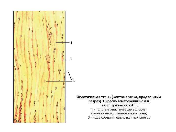 Эластическая ткань (желтая связка, продольный разрез). Окраска гематоксилином и пикрофуксином. х 400. 1 толстые