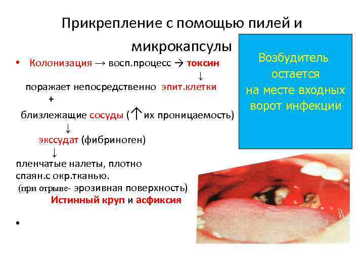 Прикрепление с помощью пилей и микрокапсулы • Колонизация → восп. процесс → токсин Возбудитель