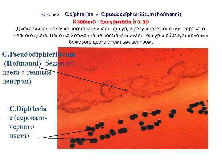 Образуют колонии. Кровяной теллуритовый агар. Corynebacterium diphtheriae кровяно-теллуритовый агар. Коринебактерии дифтерии на кровяном агаре. Дифтерийная палочка на кровяно-теллуритовом агаре.