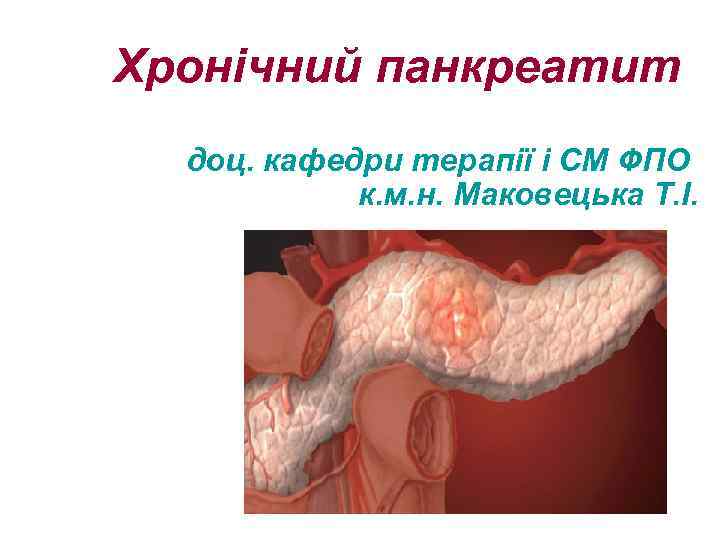 Хронічний панкреатит доц. кафедри терапії і СМ ФПО к. м. н. Маковецька Т. І.