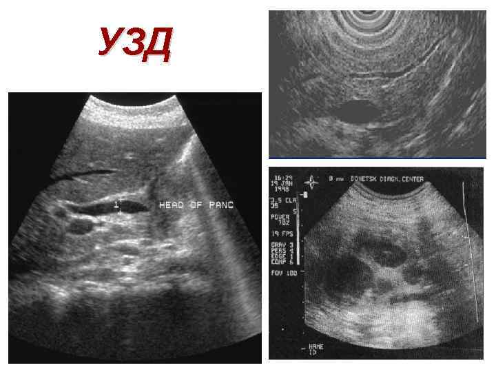 УЗД 