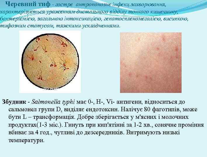 Черевний тиф - гостре антропонозне інфекц. захворювання, характерізується ураженням дистального відділу тонкого кишечнику, бактеріємією,
