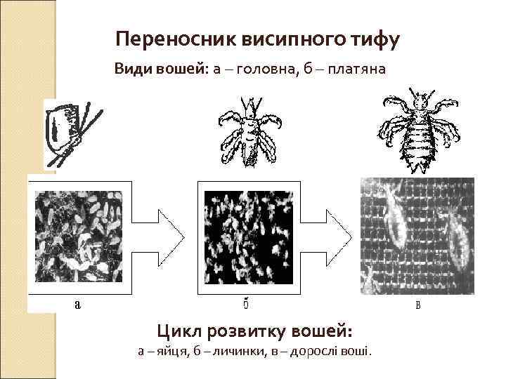 Переносник висипного тифу Види вошей: а – головна, б – платяна Цикл розвитку вошей: