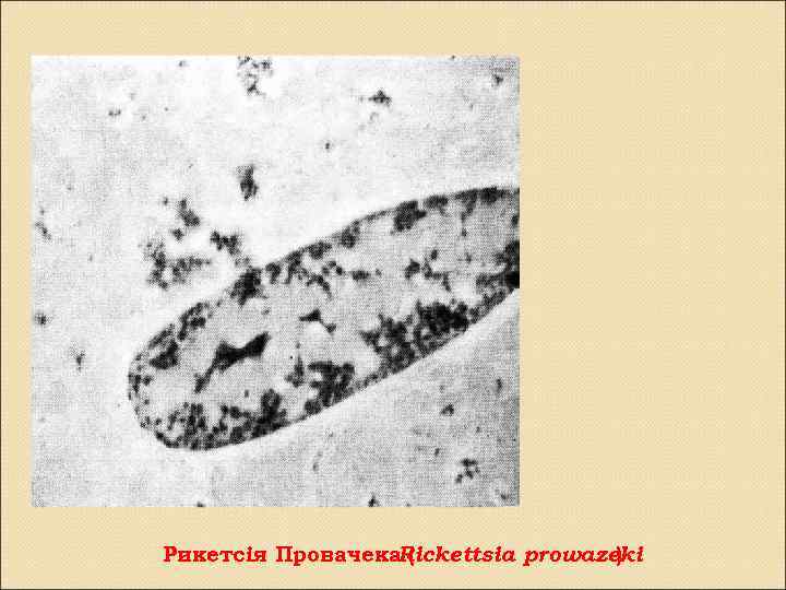 Рикетсія Провачека. Rickettsia prowazeki ( ) 