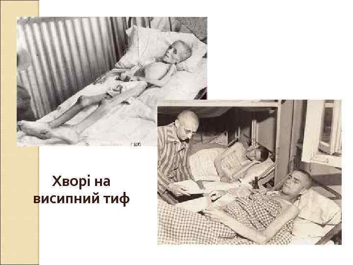 Хворі на висипний тиф 