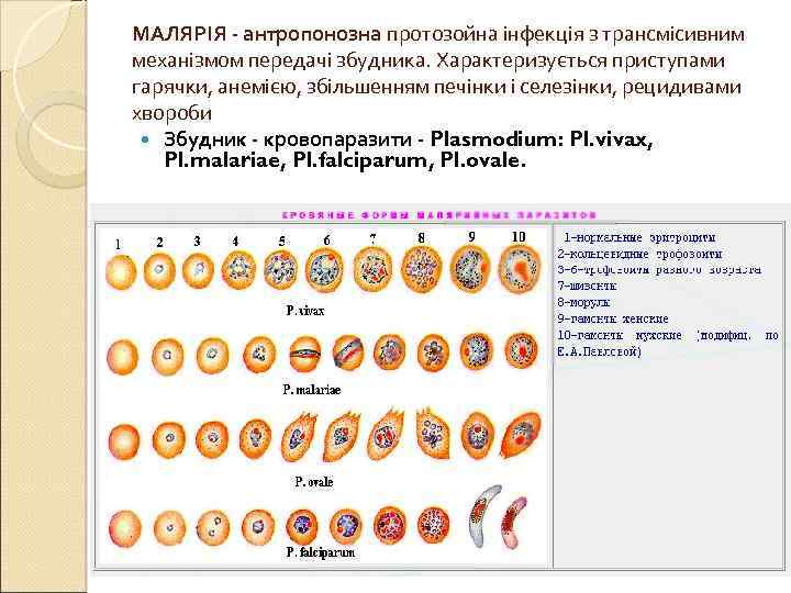 МАЛЯРІЯ - антропонозна протозойна інфекція з трансмісивним механізмом передачі збудника. Характеризується приступами гарячки, анемією,