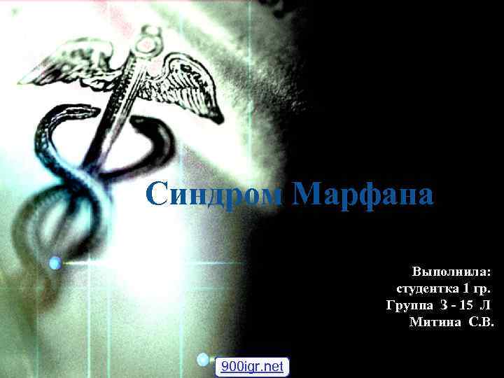 Синдром Марфана Выполнила: студентка 1 гр. Группа З - 15 Л Митина С. В.