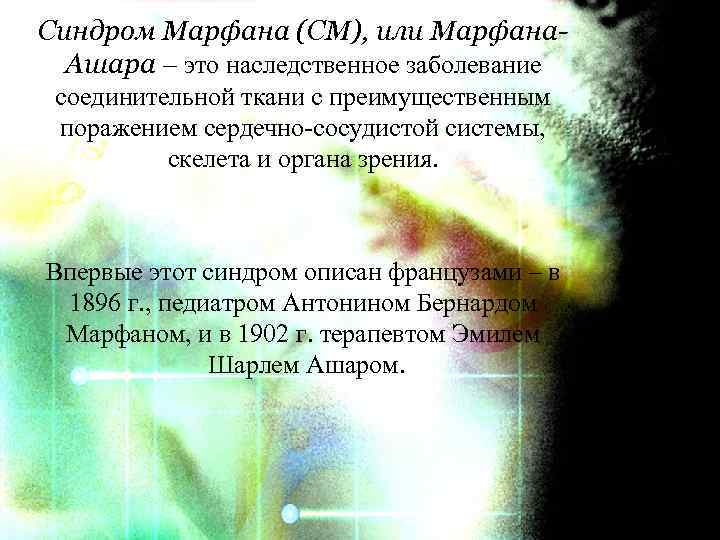 Синдром Марфана (СМ), или Марфана. Ашара – это наследственное заболевание соединительной ткани с преимущественным