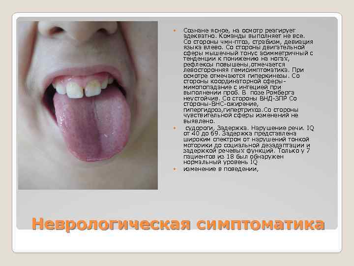  Сознане ясное, на осмотр реагирует адекватно. Команды выполняет не все. Со стороны чмн-птоз,