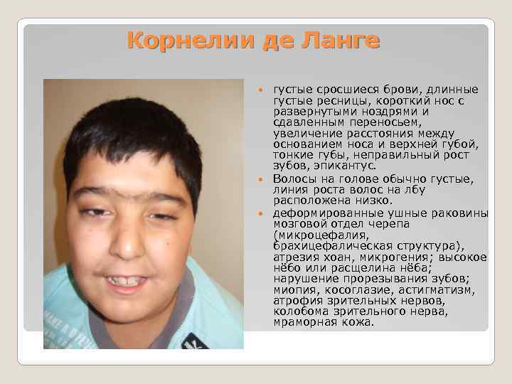 Корнелии де Ланге густые сросшиеся брови, длинные густые ресницы, короткий нос с развернутыми ноздрями