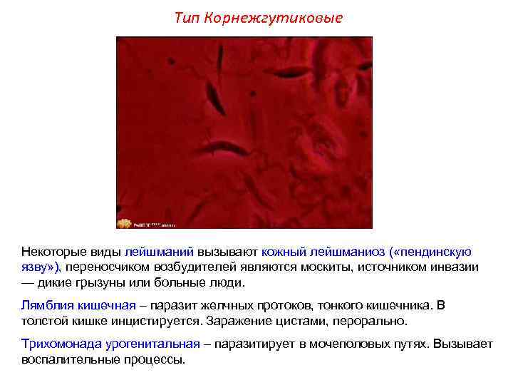 Тип Корнежгутиковые Некоторые виды лейшманий вызывают кожный лейшманиоз ( «пендинскую язву» ), переносчиком возбудителей