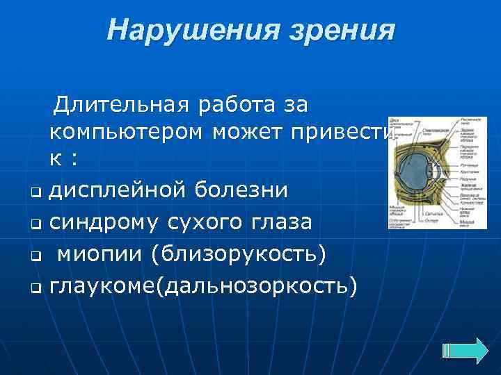 Нарушения зрения Длительная работа за компьютером может привести к: q дисплейной болезни q синдрому
