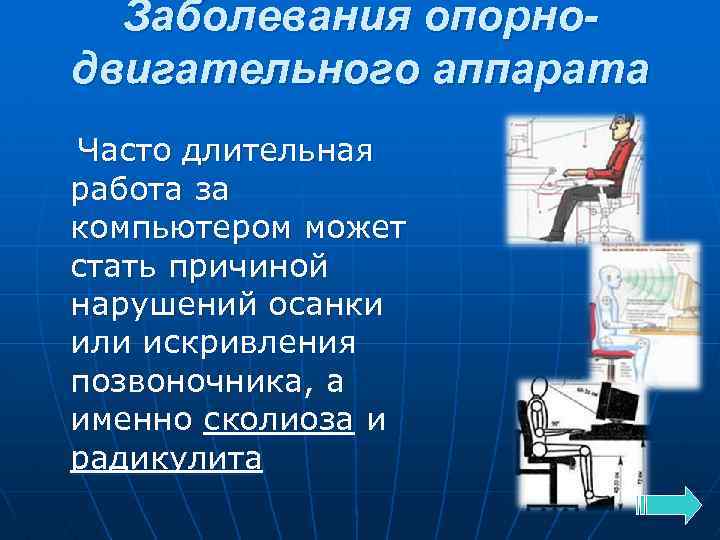 Заболевания опорнодвигательного аппарата Часто длительная работа за компьютером может стать причиной нарушений осанки или