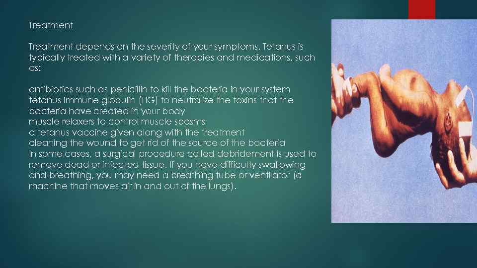 Treatment depends on the severity of your symptoms. Tetanus is typically treated with a