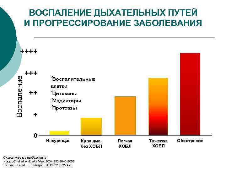 ВОСПАЛЕНИЕ ДЫХАТЕЛЬНЫХ ПУТЕЙ И ПРОГРЕССИРОВАНИЕ ЗАБОЛЕВАНИЯ Воспаление ++++ ++ + 0 Воспалительные клетки Цитокины