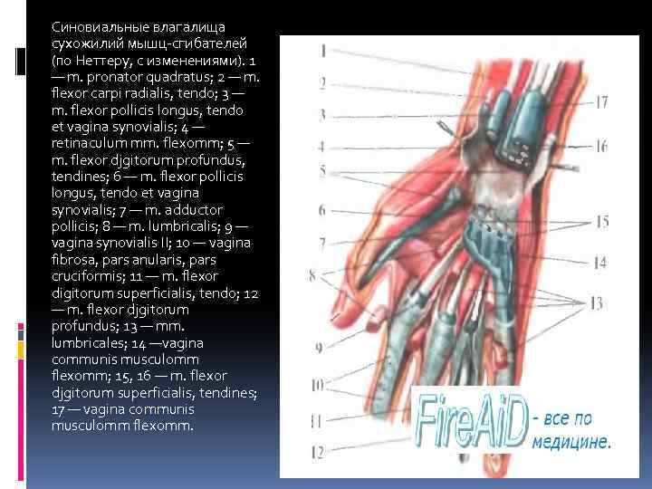 Синовиальные влагалища сухожилий мышц-сгибателей (по Неттеру, с изменениями). 1 — m. pronator quadratus; 2