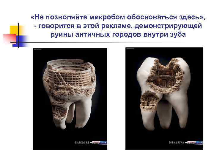  «Не позволяйте микробом обосноваться здесь» , - говорится в этой рекламе, демонстрирующей руины