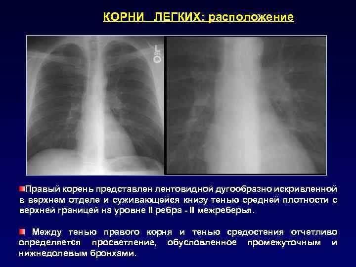 Рентгенография с прямым увеличением изображения применяется тест