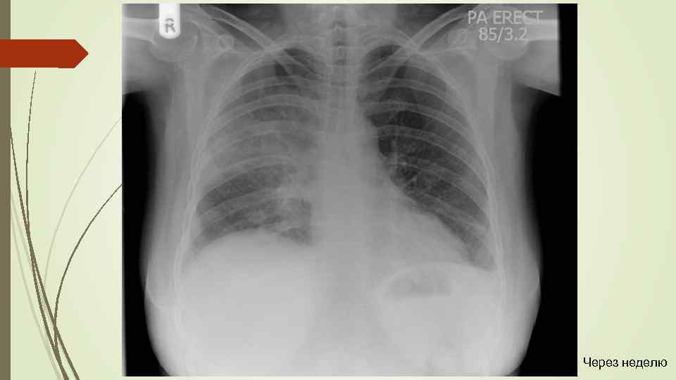 Через неделю 