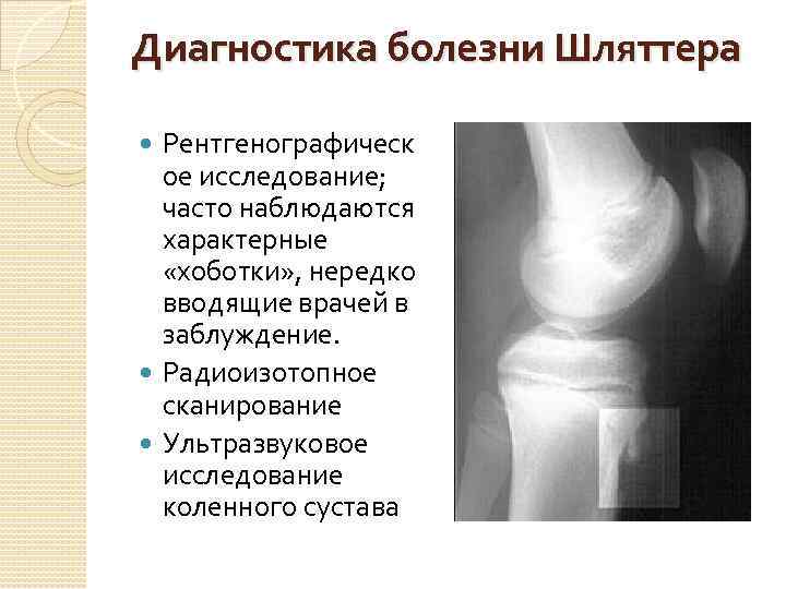 Диагностика болезни Шляттера Рентгенографическ ое исследование; часто наблюдаются характерные «хоботки» , нередко вводящие врачей