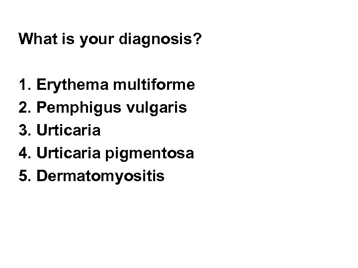 What is your diagnosis? 1. Erythema multiforme 2. Pemphigus vulgaris 3. Urticaria 4. Urticaria