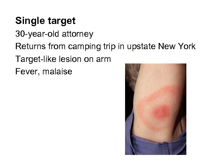 Single target 30 -year-old attorney Returns from camping trip in upstate New York Target-like