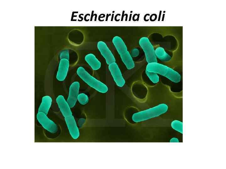 Escherichia coli 