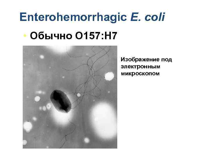 Enterohemorrhagic E. coli • Обычно O 157: H 7 Изображение под электронным микроскопом 