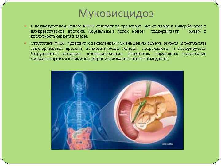 Тест нмо кистозный фиброз муковисцидоз по утвержденным