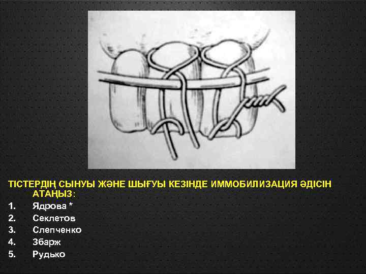 ТІСТЕРДІҢ СЫНУЫ ЖӘНЕ ШЫҒУЫ КЕЗІНДЕ ИММОБИЛИЗАЦИЯ ӘДІСІН АТАҢЫЗ: 1. Ядрова * 2. Секлетов 3.