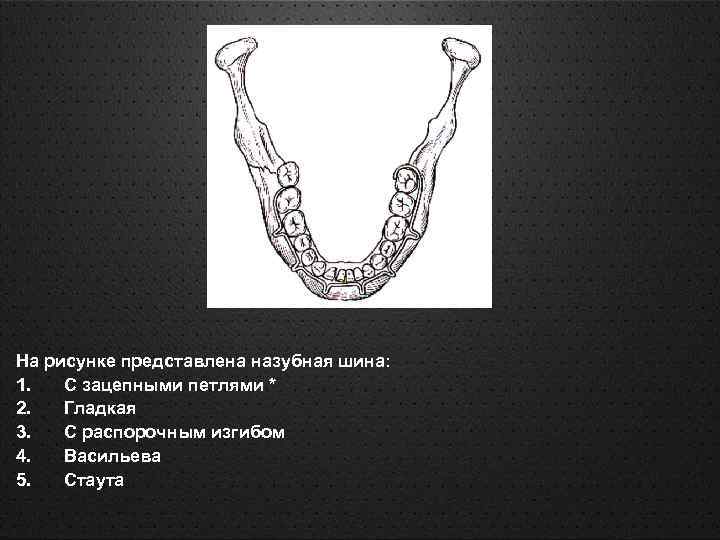 На рисунке представлена назубная шина: 1. С зацепными петлями * 2. Гладкая 3. С