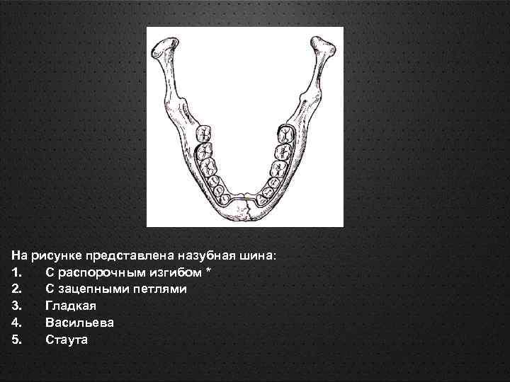 На рисунке представлена назубная шина: 1. С распорочным изгибом * 2. С зацепными петлями