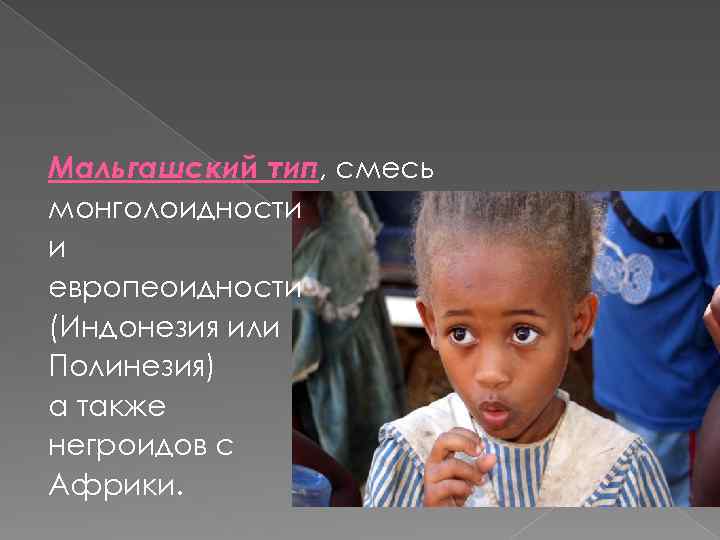 Мальгашский тип, смесь монголоидности и европеоидности (Индонезия или Полинезия) а также негроидов с Африки.