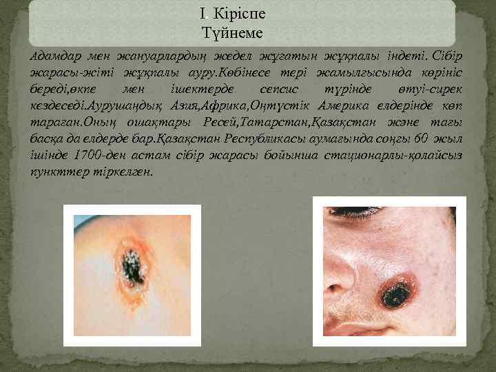 І. Кіріспе Түйнеме Адамдар мен жануарлардың жедел жұғатын жұқпалы індеті. Сібір жарасы-жіті жұқпалы ауру.