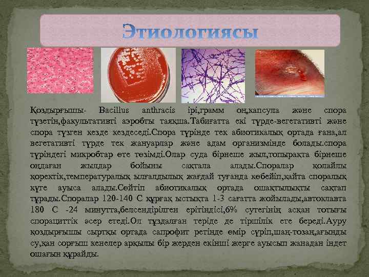 Қоздырғышы- Bacillus anthracis ірі, грамм оң, капсула және спора түзетін, факультативті аэробты таяқша. Табиғатта