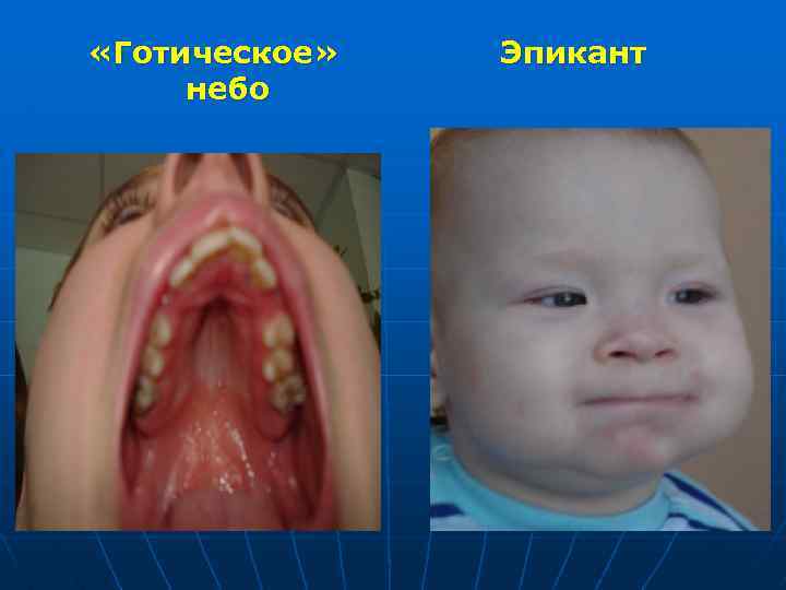  «Готическое» небо Эпикант 